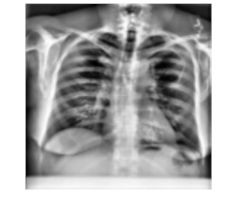 Disease Classification on Medical XRay Images